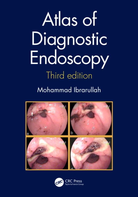 Atlas of Diagnostic Endoscopy, 3E, PDF eBook