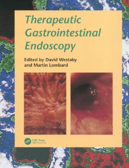 Therapeutic Gastrointestinal Endoscopy, PDF eBook