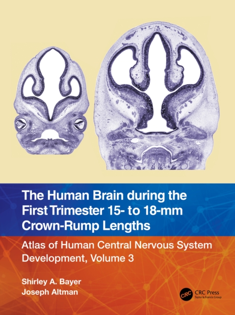 The Human Brain during the First Trimester 15- to 18-mm Crown-Rump Lengths : Atlas of Human Central Nervous System Development, Volume 3, EPUB eBook