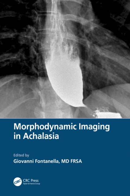 Morphodynamic Imaging in Achalasia, PDF eBook