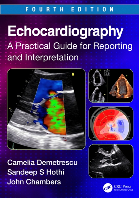 Echocardiography : A Practical Guide for Reporting and Interpretation, PDF eBook