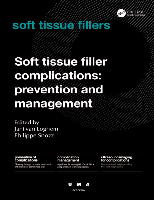 Soft Tissue Filler Complications : Prevention and Management, PDF eBook