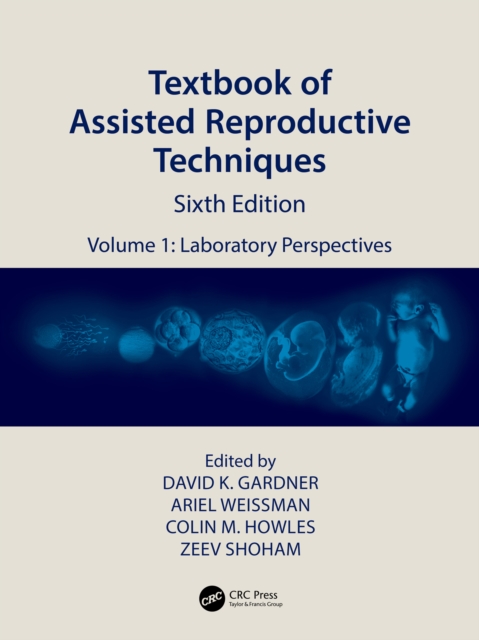 Textbook of Assisted Reproductive Techniques : Volume 1: Laboratory Perspectives, PDF eBook