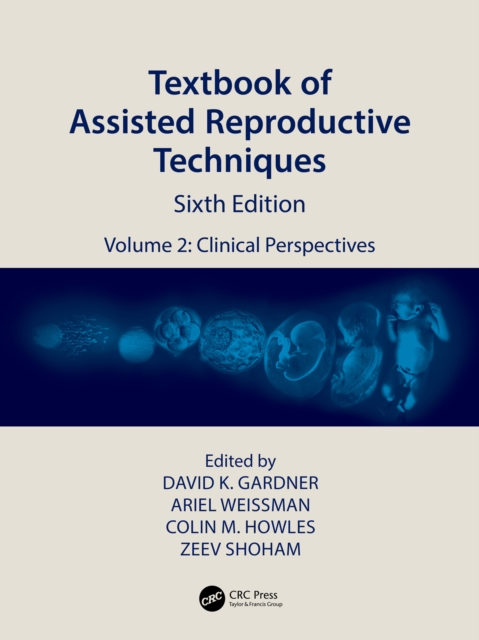 Textbook of Assisted Reproductive Techniques : Volume 2: Clinical Perspectives, EPUB eBook