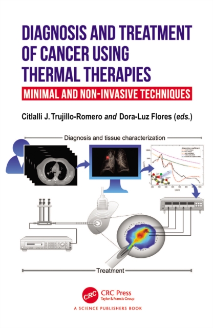Diagnosis and Treatment of Cancer using Thermal Therapies : Minimal and Non-invasive Techniques, PDF eBook