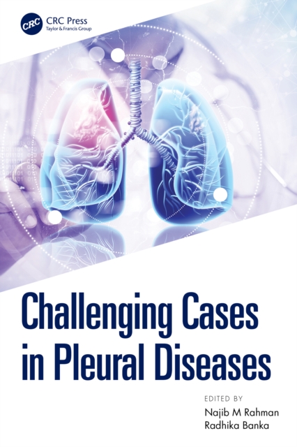 Challenging Cases in Pleural Diseases, EPUB eBook