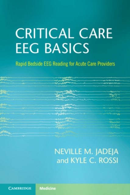 Critical Care EEG Basics : Rapid Bedside EEG Reading for Acute Care Providers, EPUB eBook