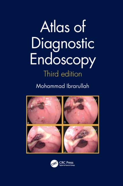 Atlas of Diagnostic Endoscopy, 3E, Paperback / softback Book