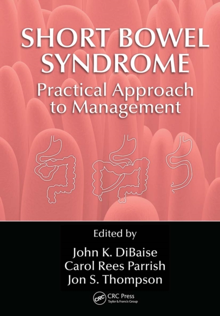 Short Bowel Syndrome : Practical Approach to Management, Paperback / softback Book