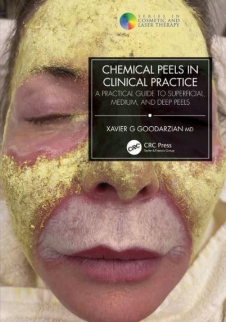 Chemical Peels in Clinical Practice : A Practical Guide to Superficial, Medium, and Deep Peels, Paperback / softback Book