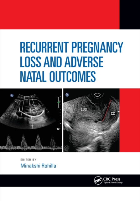 Recurrent Pregnancy Loss and Adverse Natal Outcomes, Paperback / softback Book