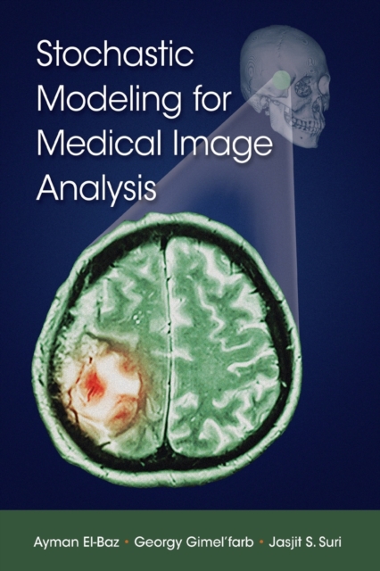 Stochastic Modeling for Medical Image Analysis, Paperback / softback Book