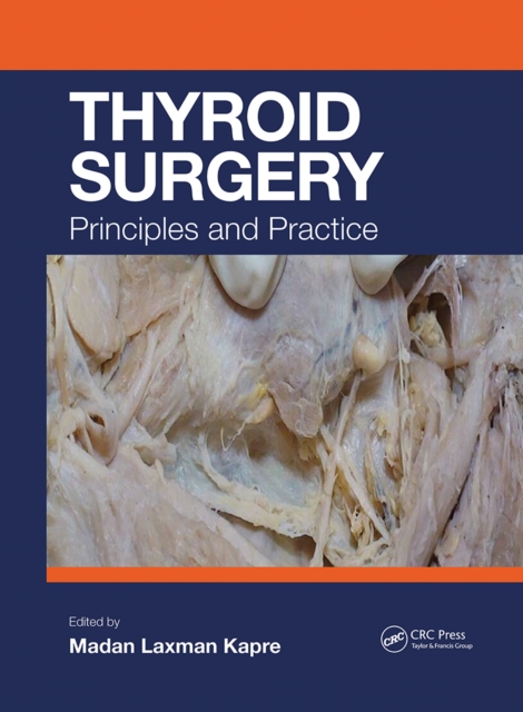Thyroid Surgery : Principles and Practice, Paperback / softback Book