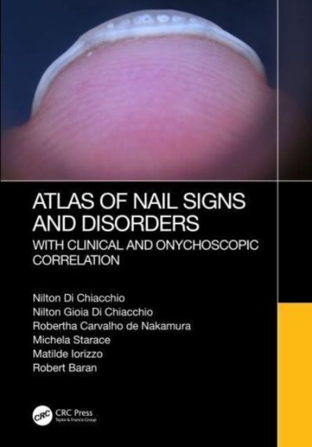 Atlas of Nail Signs and Disorders with Clinical and Onychoscopic Correlation, Hardback Book