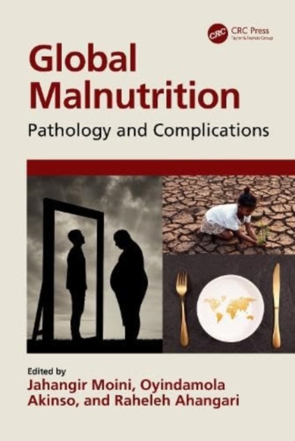 Global Malnutrition : Pathology and Complications, Hardback Book