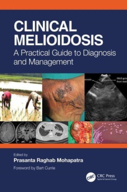 Clinical Melioidosis : A Practical Guide to Diagnosis and Management, Paperback / softback Book