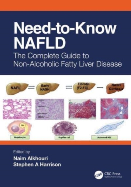 Need-to-Know NAFLD : The Complete Guide to Nonalcoholic Fatty Liver Disease, Paperback / softback Book