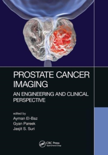 Prostate Cancer Imaging : An Engineering and Clinical Perspective, Paperback / softback Book