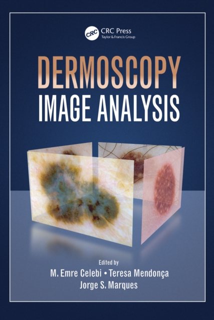 Dermoscopy Image Analysis, EPUB eBook
