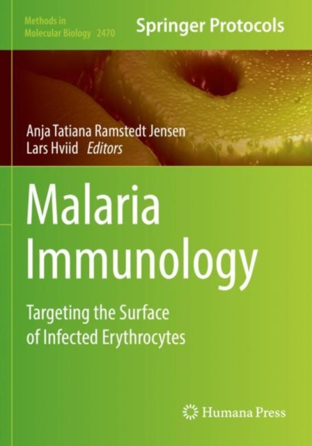 Malaria Immunology : Targeting the Surface of Infected Erythrocytes, Paperback / softback Book