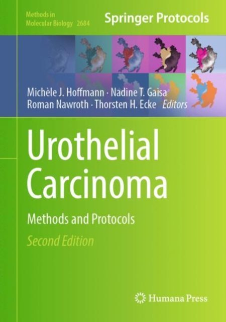 Urothelial Carcinoma : Methods and Protocols, Hardback Book