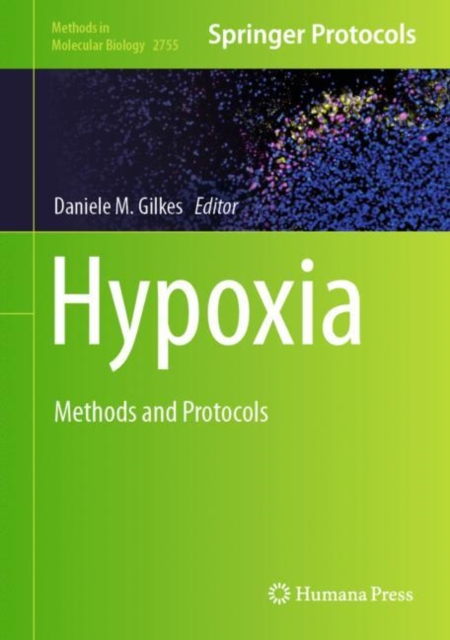 Hypoxia : Methods and Protocols, Hardback Book