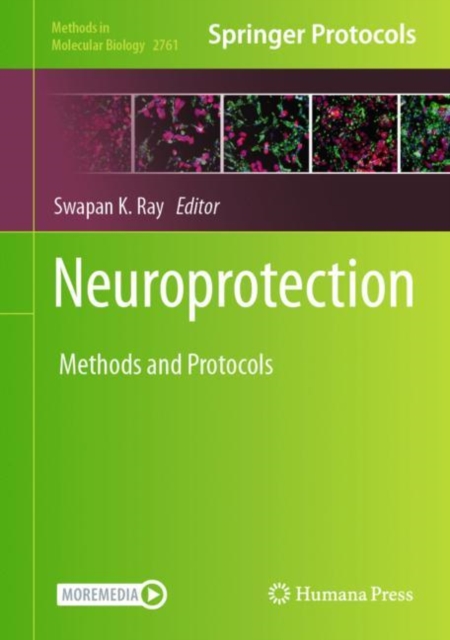 Neuroprotection : Method and Protocols, EPUB eBook