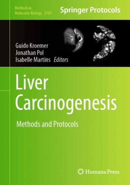 Liver Carcinogenesis : Methods and Protocols, Hardback Book