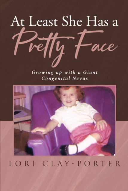 At Least She Has a Pretty Face : Growing up with a Giant Congenital Nevus, EPUB eBook