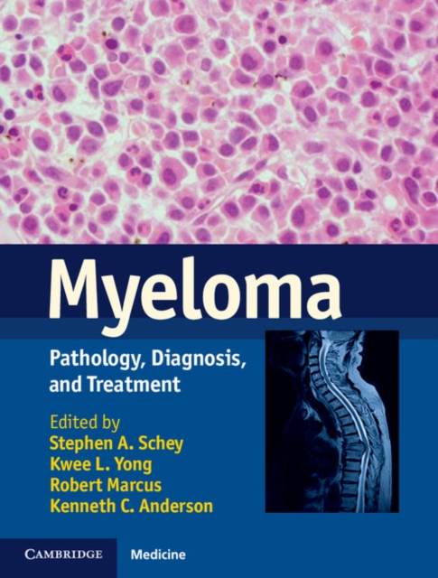 Myeloma : Pathology, Diagnosis, and Treatment, Hardback Book