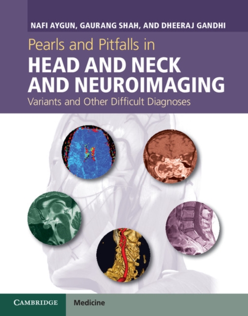 Pearls and Pitfalls in Head and Neck and Neuroimaging : Variants and Other Difficult Diagnoses, Hardback Book
