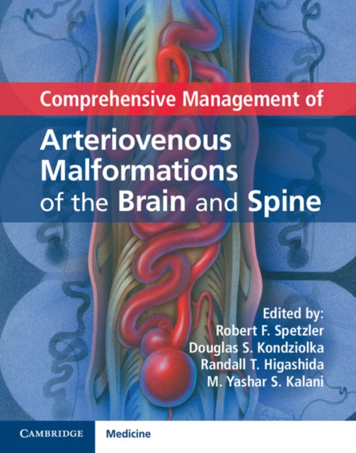 Comprehensive Management of Arteriovenous Malformations of the Brain and Spine, Hardback Book