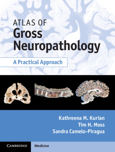 Atlas of Gross Neuropathology Book and Online Bundle : A Practical Approach, Multiple-component retail product Book