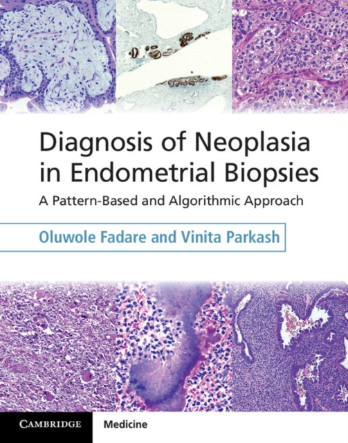 Diagnosis of Neoplasia in Endometrial Biopsies Book and Online Bundle : A Pattern-Based and Algorithmic Approach, Multiple-component retail product Book
