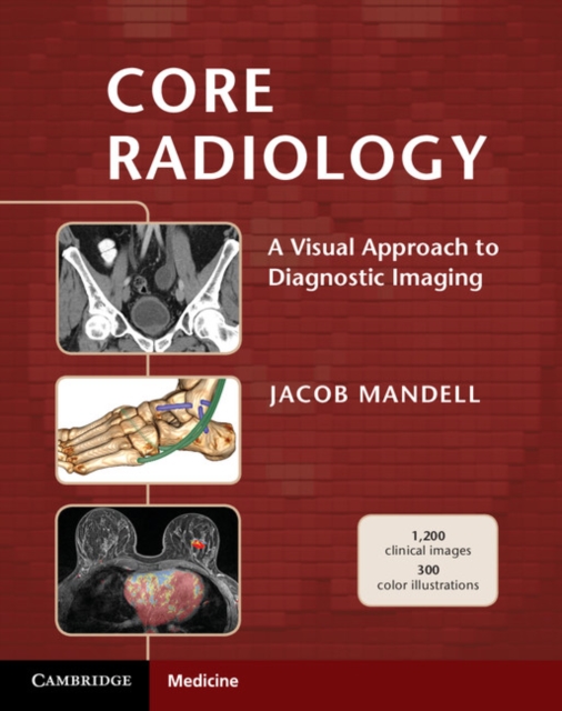 Core Radiology : A Visual Approach to Diagnostic Imaging, PDF eBook