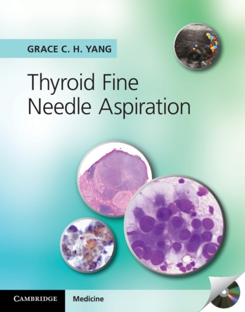 Thyroid Fine Needle Aspiration, PDF eBook