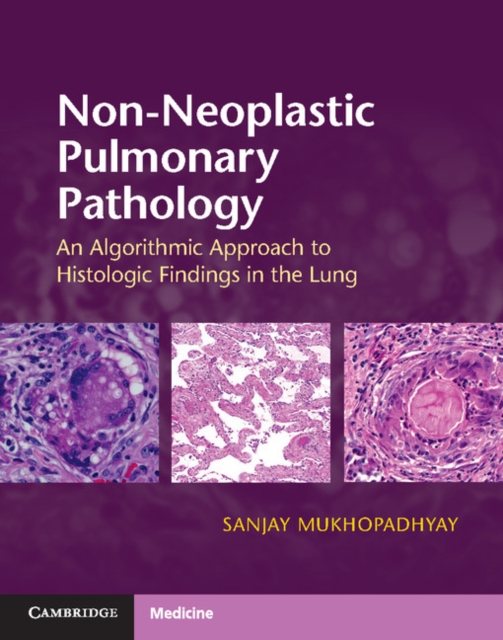 Non-Neoplastic Pulmonary Pathology with Online Resource : An Algorithmic Approach to Histologic Findings in the Lung, Multiple-component retail product Book