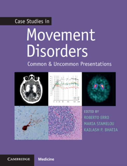 Case Studies in Movement Disorders : Common and Uncommon Presentations, Paperback / softback Book
