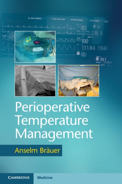 Perioperative Temperature Management, Paperback / softback Book