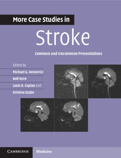 More Case Studies in Stroke : Common and Uncommon Presentations, Paperback / softback Book