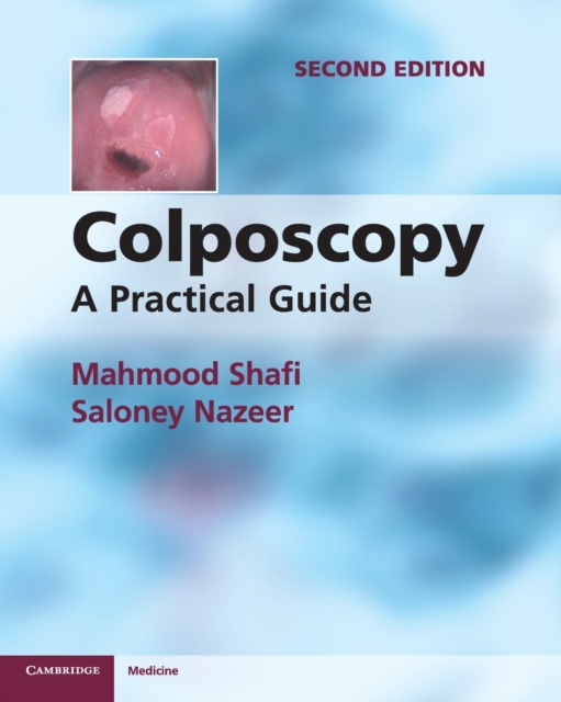 Colposcopy : A Practical Guide, Paperback / softback Book