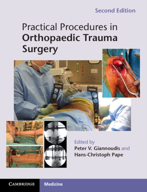 Practical Procedures in Orthopaedic Trauma Surgery, EPUB eBook