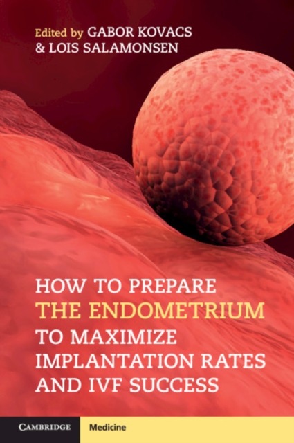 How to Prepare the Endometrium to Maximize Implantation Rates and IVF Success, Paperback / softback Book