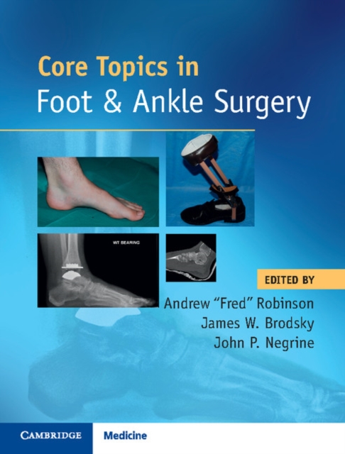 Core Topics in Foot and Ankle Surgery, Hardback Book
