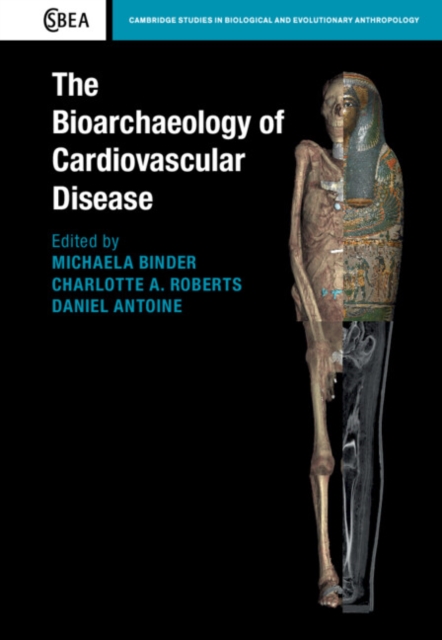 The Bioarchaeology of Cardiovascular Disease, Hardback Book