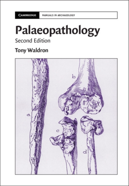 Palaeopathology, Hardback Book
