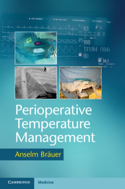 Perioperative Temperature Management, PDF eBook