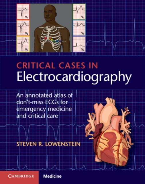 Critical Cases in Electrocardiography : An Annotated Atlas of Don't-Miss ECGs for Emergency Medicine and Critical Care, PDF eBook