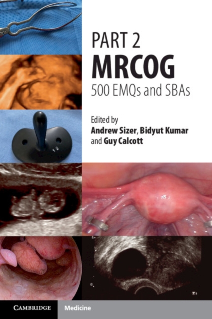 Part 2 MRCOG: 500 EMQs and SBAs, EPUB eBook