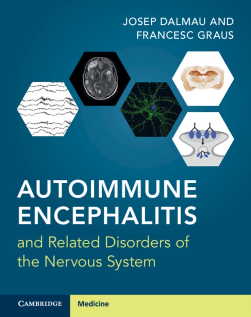 Autoimmune Encephalitis and Related Disorders of the Nervous System, Multiple-component retail product Book
